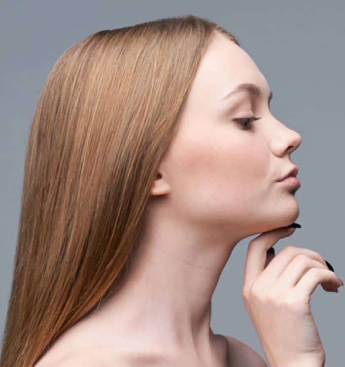 woman after seeing rhinoplasty surgeon in Miami, FL