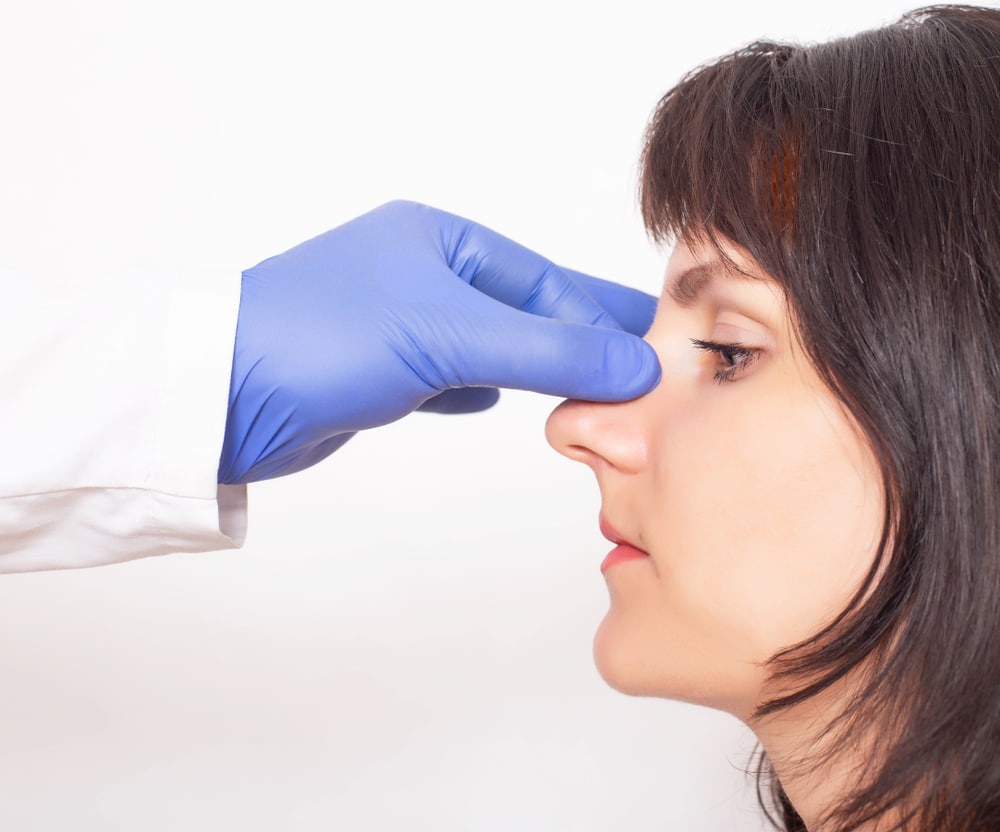 Dr. Anthony Bared provides Rib Revision Rhinoplasty at Miami, FL.