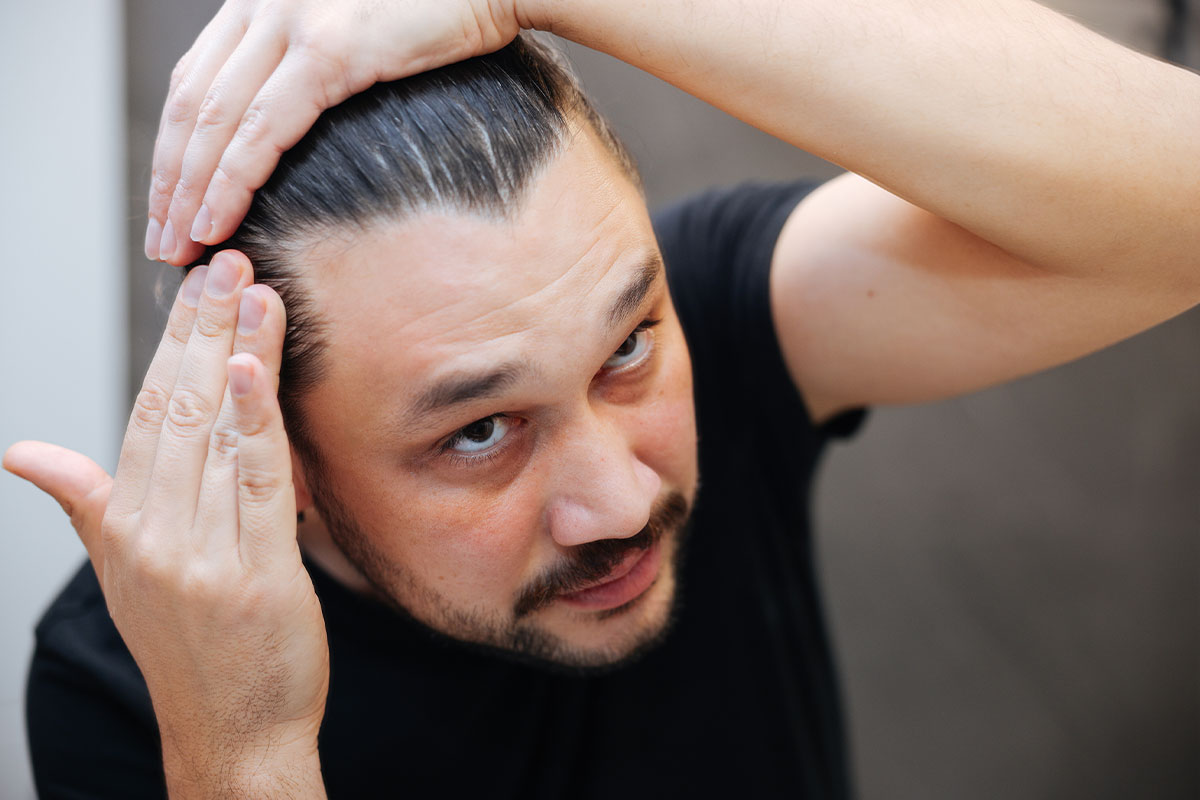 Why Am I Losing My Hair? Common Causes and Solutions for Thinning Hair